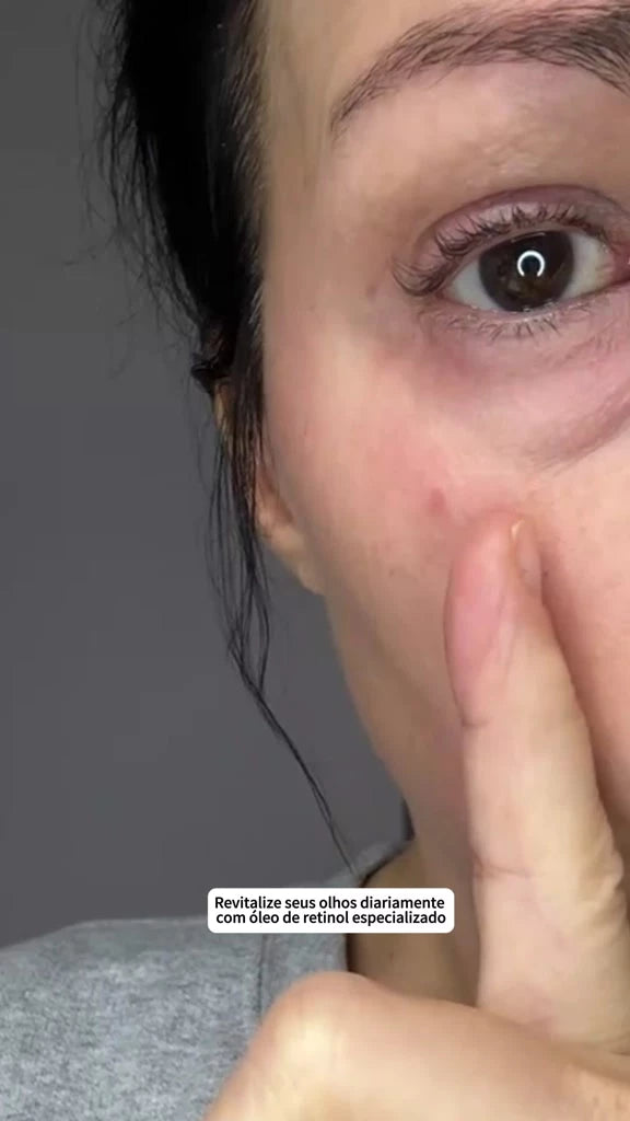 Óleo Sérum Revitalizante Antirrugas com Retinol para Olhos – Roll-on Hidratante, Redutor de Linhas Finas e Olheiras