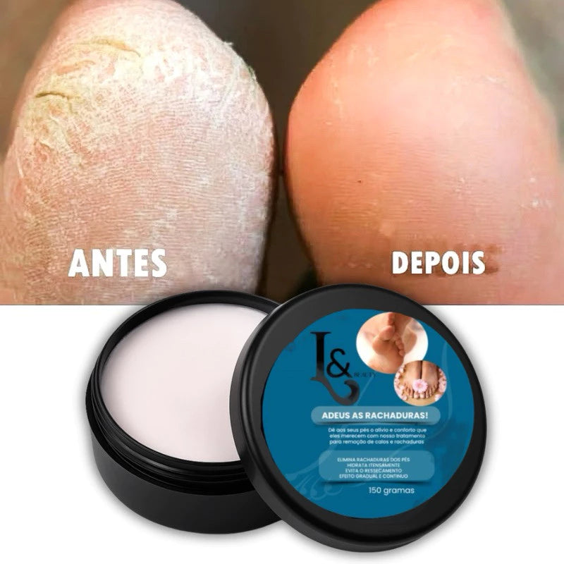 Creme Para Rachaduras Fissura Dos Pés Tratamento 150g - L&Beauty